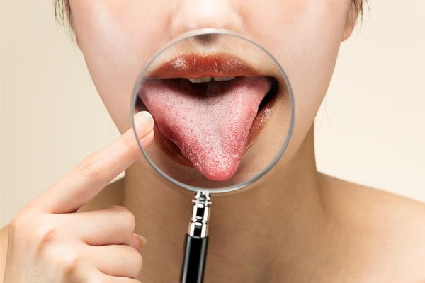 舌の奥や側面にできる痛いぶつぶつの理由は？原因と対処方法