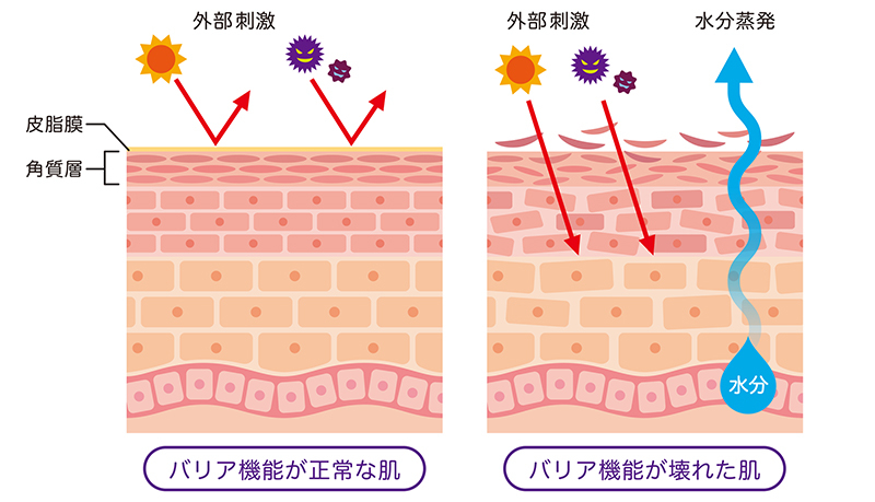 バリア機能が正常な肌と、バリア機能が壊れた肌の違いの解説図